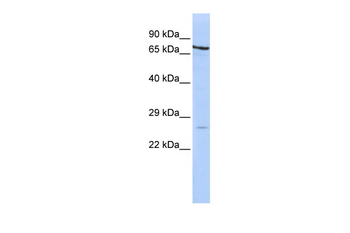 PSMB4 Rabbit Polyclonal Antibody