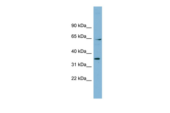 RANGAP1 Rabbit Polyclonal Antibody