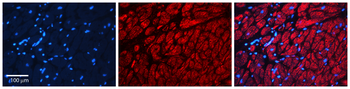 S100A9 Rabbit Polyclonal Antibody