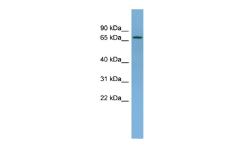 NDUFS1 Rabbit Polyclonal Antibody