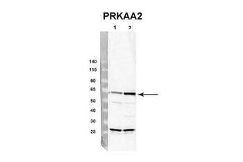 PRKAA2 Rabbit Polyclonal Antibody