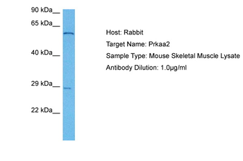 PRKAA2 Rabbit Polyclonal Antibody