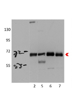 PRKAA2 Rabbit Polyclonal Antibody