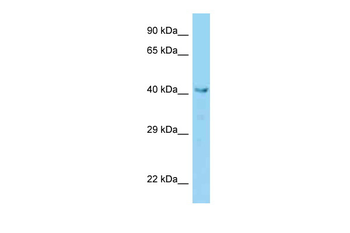 Vps36 Rabbit Polyclonal Antibody