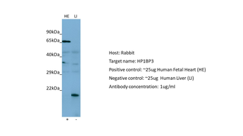 HP1BP3 Rabbit Polyclonal Antibody