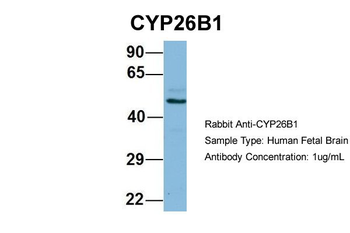CYP26B1 Rabbit Polyclonal Antibody