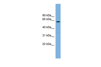CYP26B1 Rabbit Polyclonal Antibody