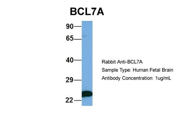 BCL7A Rabbit Polyclonal Antibody