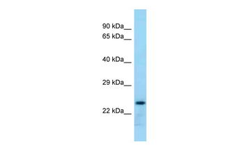 Rab17 Rabbit Polyclonal Antibody