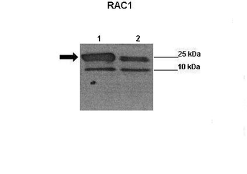 RAC1 Rabbit Polyclonal Antibody