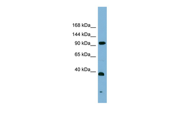 ERCC4 Rabbit Polyclonal Antibody