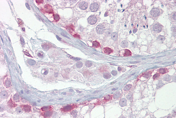 SYCP1 Rabbit Polyclonal Antibody