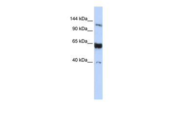 SYCP1 Rabbit Polyclonal Antibody