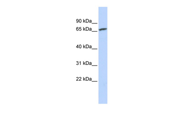 IGF2BP1 Rabbit Polyclonal Antibody