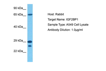 IGF2BP1 Rabbit Polyclonal Antibody