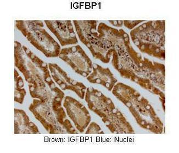 IGF2BP1 Rabbit Polyclonal Antibody
