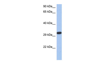 CAPZA3 Rabbit Polyclonal Antibody