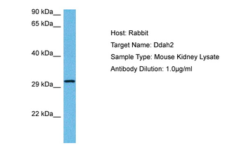 DDAH2 Rabbit Polyclonal Antibody