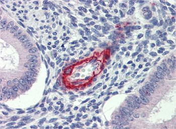 DDAH2 Rabbit Polyclonal Antibody