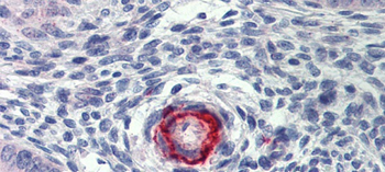 DDAH2 Rabbit Polyclonal Antibody