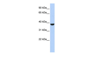 PPP1CA Rabbit Polyclonal Antibody