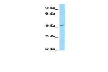 APOL1 Rabbit Polyclonal Antibody