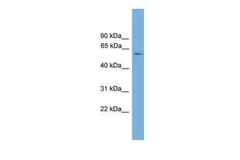 ATG16L1 Rabbit Polyclonal Antibody