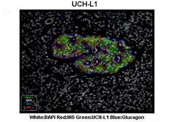 UCHL1 Rabbit Polyclonal Antibody