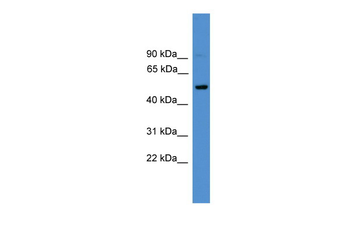 CD4 Rabbit Polyclonal Antibody