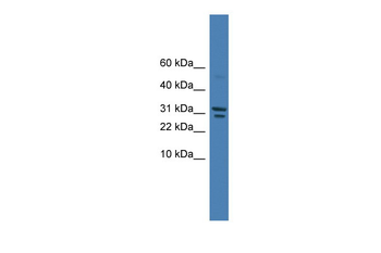 SPINT2 Rabbit Polyclonal Antibody