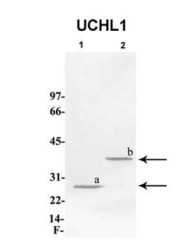 UCHL1 Rabbit Polyclonal Antibody
