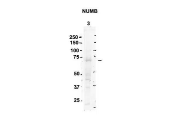 Numb Rabbit Polyclonal Antibody