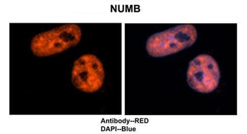 Numb Rabbit Polyclonal Antibody