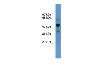 Syt1 Rabbit Polyclonal Antibody