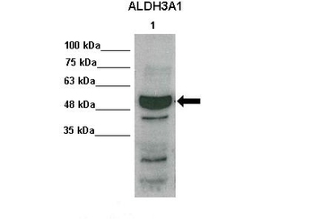 ALDH3A1 Rabbit Polyclonal Antibody