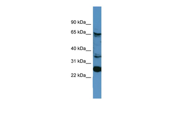 CANX Rabbit Polyclonal Antibody