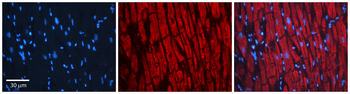 MARCKS Rabbit Polyclonal Antibody