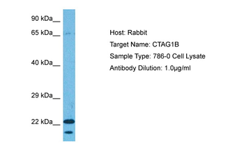CTAG1B Rabbit Polyclonal Antibody