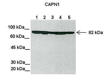 CAPN1 Rabbit Polyclonal Antibody