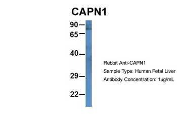 CAPN1 Rabbit Polyclonal Antibody