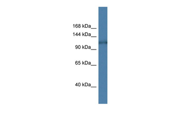 HK1 Rabbit Polyclonal Antibody