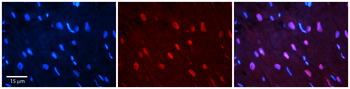 TPR Rabbit Polyclonal Antibody