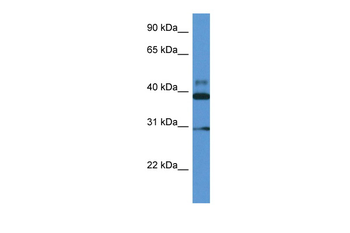 VASP Rabbit Polyclonal Antibody