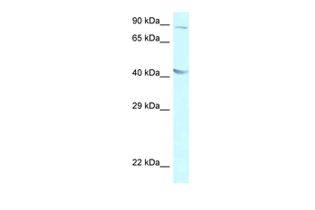 GALR2 Rabbit Polyclonal Antibody