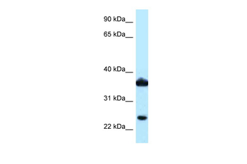 AKR1C3 Rabbit Polyclonal Antibody