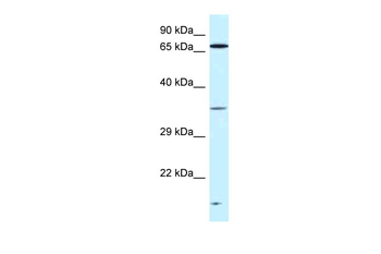 VPS26A Rabbit Polyclonal Antibody