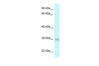 SRA1 Rabbit Polyclonal Antibody