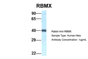 RBMX Rabbit Polyclonal Antibody