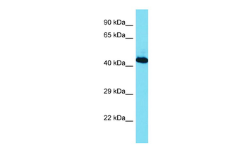RBMX Rabbit Polyclonal Antibody