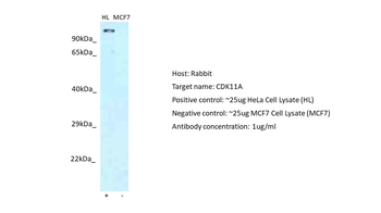 CDK11A Rabbit Polyclonal Antibody